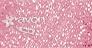 Obrázek k výrobku Práškové oční stíny Stardust varianta - Think Pink